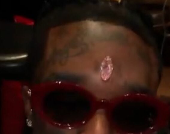 Lil Uzi Vert Implants Pink Diamond Worth N9.4 Billion Naira On Forehead
