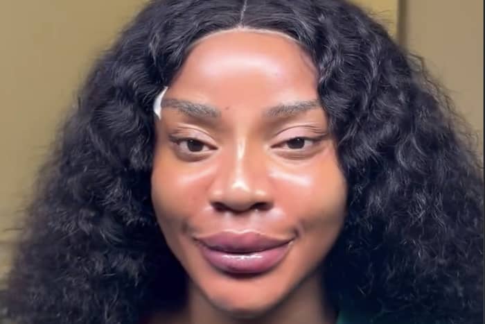 “I look so different” — Uche Ogbodo speaks after facial procedure